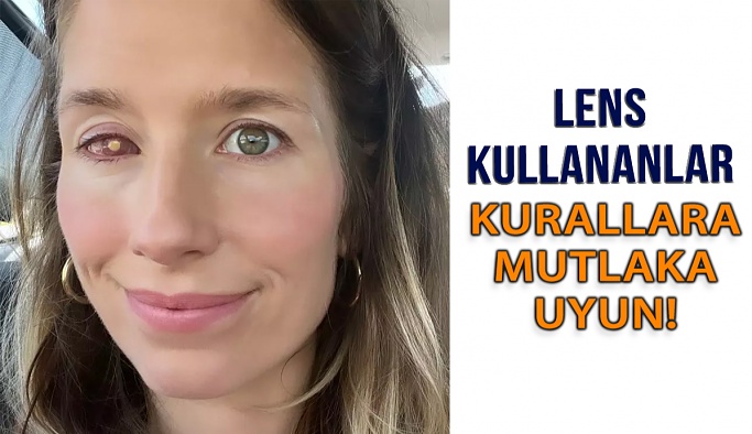 Kontak Lens Kullanımında Kurallara Mutlaka Uyun