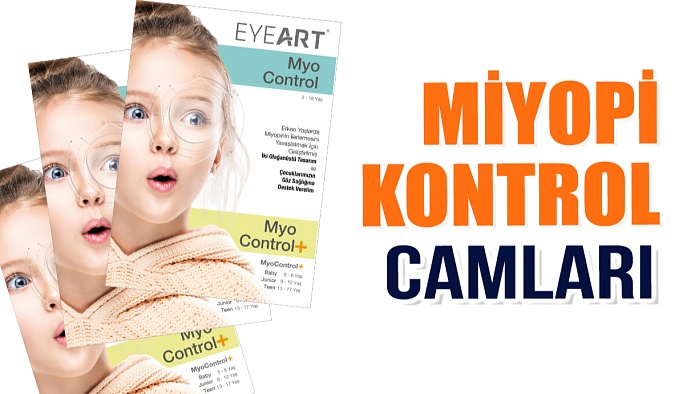 MyoControl Miyopi Kontrol Camları