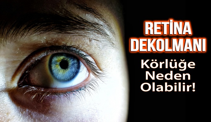 Retina Dekolmanı Körlüğe Neden Olabilir