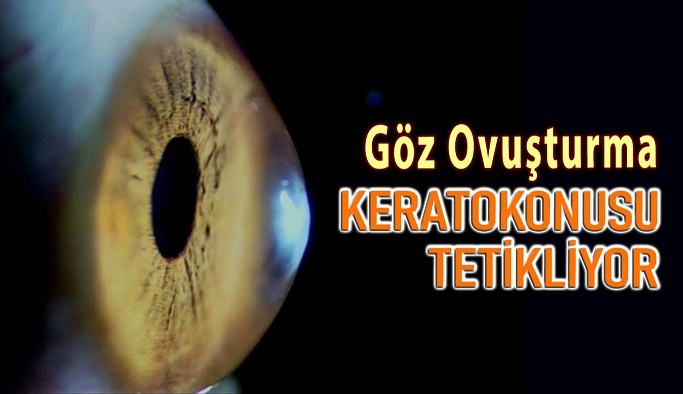 Göz Ovuşturma Alışkanlığı, Keratokonus Hastalığını Tetikliyor