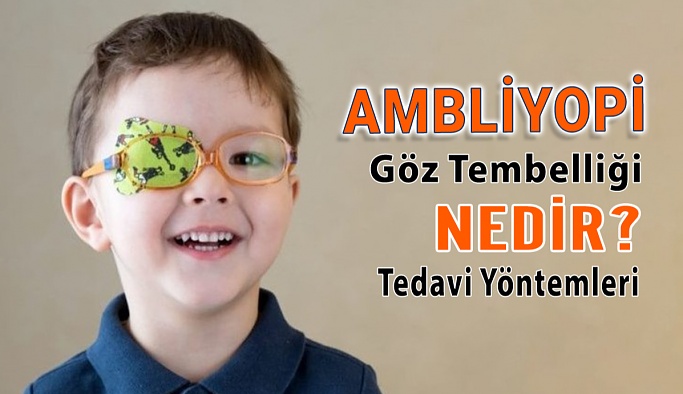 Göz Tembelliği Ambliyopi Nedir?