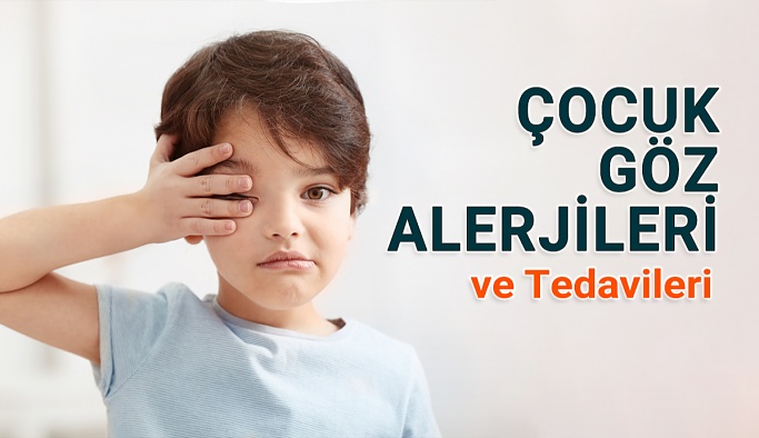 Çocuklarda Göz Alerjileri: Tedavi ve Rahatlatma İpuçları