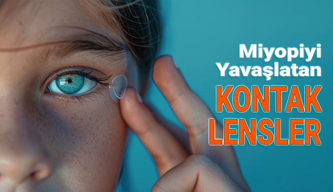 Çocuklarda Miyopiyi Yavaşlatan Kontak Lensler