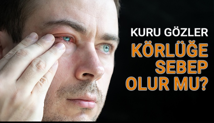 Kuru Gözler Körlüğe Sebep Olabilir Mi?