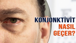 Konjonktivit (Pembe Göz) Nasıl Geçer?