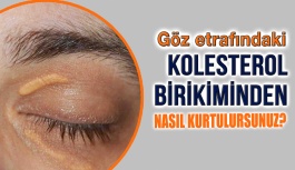 Göz Altlarındaki Kolesterol Birikimlerinden Nasıl Kurtulunur?