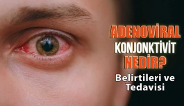 Adenoviral Konjonktivit Nedir?