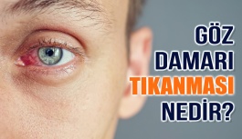 Göz Damarı Tıkanması Nedir?