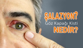 Şalazyon, Göz Kapağı Kisti Nedir?