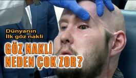 Göz Nakli Neden Çok Zor