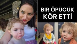 Bir Öpücük Küçük Çocuğu Kör Etti!